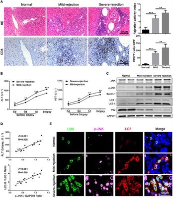 JNK signaling mediates acute rejection via activating autophagy of CD8+ T cells after liver transplantation in rats